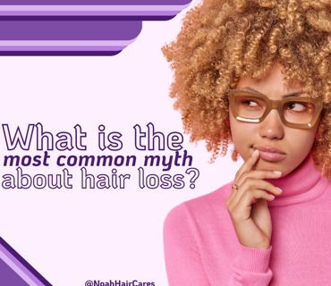 What is the most common myth about hair loss?